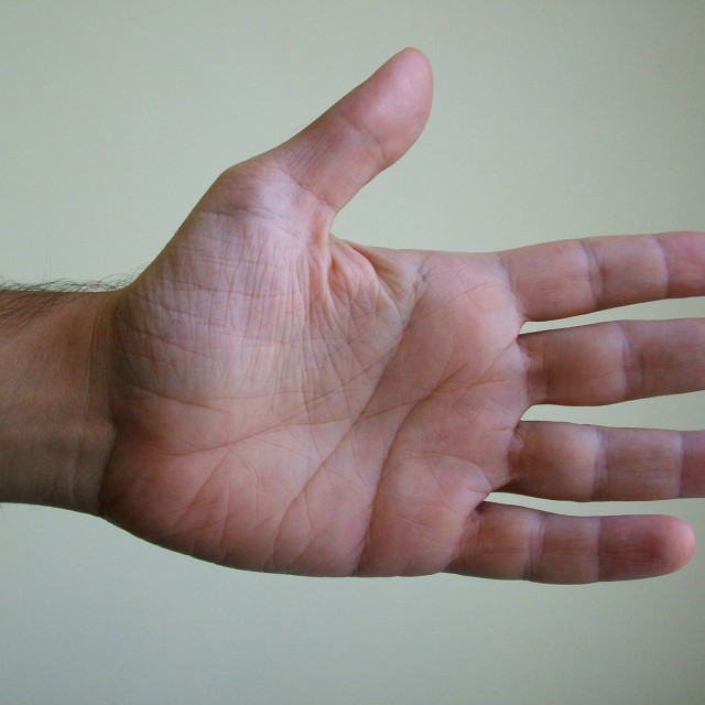 How do you stop your hands from sweating?